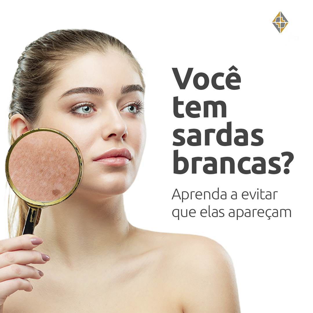 Imagem destaque de Você tem sardas brancas? Aprenda a evitar que elas apareçam